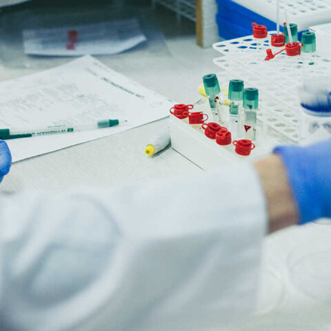 Біохімічна оцінка функціонального стану підшлункової залози