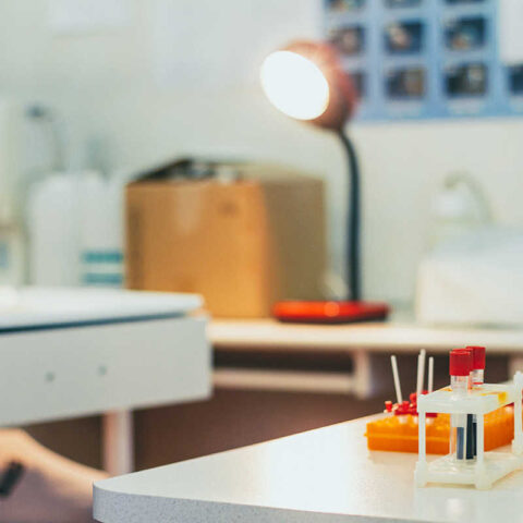 Діагностика атеросклерозу